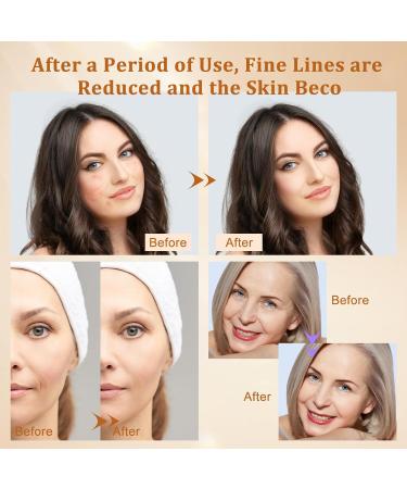 Hotodeal LED Face Mask - 7 Colors Light Therapy for Anti-Aging & Skin Rejuvenation | Foldable & Portable Silicone Mask for Face & Neck - Buy Online on GoSupps.com