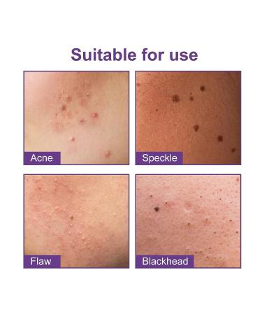 144Pcs Acne Stickers for Home, Irregular Shape Pimple Elimination - Acne Patches - Buy Online on GoSupps.com
