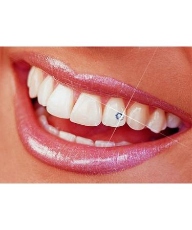 SmileWorld Blue Gel 35% Desmineralization Kit with Lip Expander - Dental Etch for Precision - Viscous Formula - Made in USA (3 Units) - Buy Online on GoSupps.com