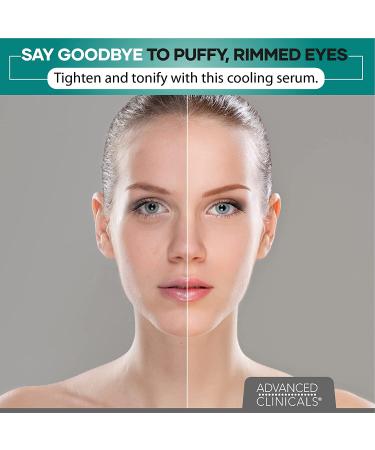 Advanced Clinicals Puffy Eye Serum - Professional Correction 1.75 fl oz | Reduce Dark Circles & Puffiness - Buy Online on GoSupps.com