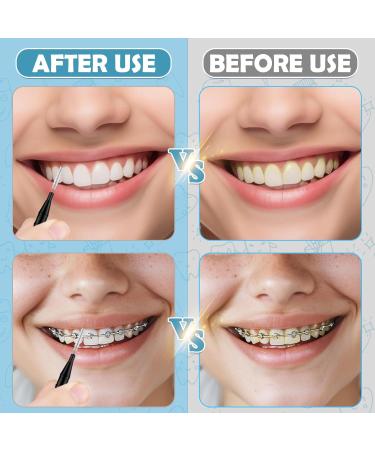 120 Pieces Interdental Brushes & Flossers - Soft Bristles 360 Bendable Tooth Cleaners for Optimal Dental Hygiene | International Shipping Available - Buy Online on GoSupps.com