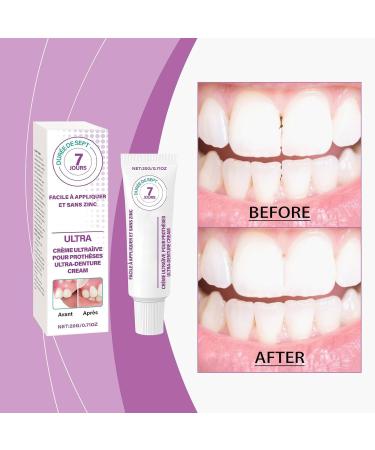 Dentures Adhesive Cream 118x496 Inches Teeth Glue For Denture 20g AllDay Wear LongLasting Adhesion Paste For Any Mouth Shape Women Men Adults Beginners - Buy Online on GoSupps.com