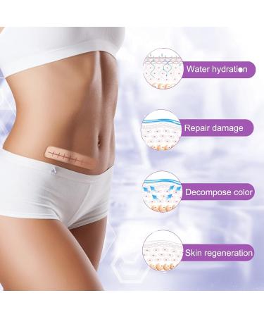 Silicone Scar Removal Sheets (Pack of 4) - 5.9 x 1.6 - Body, Surgical, Burn, Acne & Keloid Treatment - 2 Month Supply - Buy Online on GoSupps.com