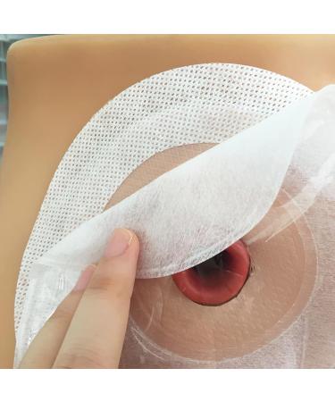 EXCEART Ostomy Adhesive Strips Ostomy Skin Strips Stoma Adhesive Strips Ostomy Barrier Strips Colostomy Bag Adhesive Strips Ostomy Elastic Strip for Stoma Nursing(20Pcs) - Buy Online on GoSupps.com