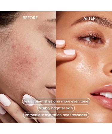 AbsolutSkin Brightening Face Wash Gentle Daily Cleanser with Kojic Acid Vitamin C & Alpha Arbutin Fades Dark Spots & Evens Skin Tone 120ml - Buy Online on GoSupps.com