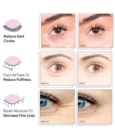 Grace & Stella Vegan Eye Wrinkle Pads with Niacinamide - 24 Pairs Blue Gel Under Eye Masks for Dark Circles, Puffy Eyes, and Wrinkles - Cruelty-Free - Buy Online on GoSupps.com