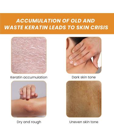 Orange Brightening Exfoliating Gel Moisturising Exfoliation Natural Orange Exfoliating Gel Deep Cleansing Exfoliating Gel Women's Face Exfoliating Gel for Face - Buy Online on GoSupps.com