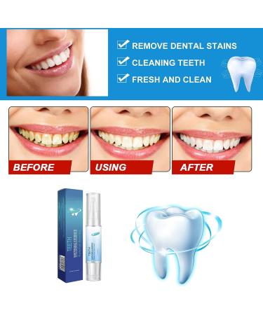 Herbaluxy Teeth Whitening Kit - 3PCS Essence Pens for Stain Removal and Brighter Teeth - Buy Online on GoSupps.com