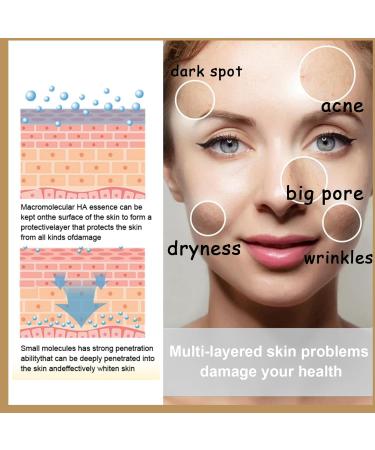 Rice Toner 150ML Smoothing Pore Minimizer & Moisturising Facial Toner - Niacinamide Essence for Dry Skin - Redness & Exfoliating - 1pc - Buy Online on GoSupps.com