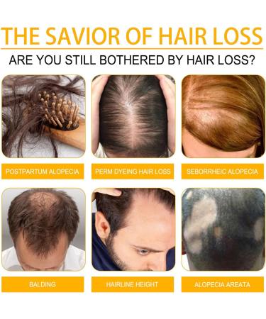 KiJalyelu Biotin Fast-growing Hair Essential Oil for Hair Loss Biotin Roll-On Oil for Thin Hair Hydrating & Nourishing Anti Hair Growth Serum Fuller and Faster Growing Hair - 30ml (1PC) - Buy Online on GoSupps.com