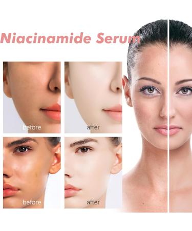 KOAHDE 70% Niacinamide Serum Anti-Aging Face Serum with Peach Extract Brightening Hydrating Face Glow Serum Face Moisturiser Anti-Aging Face Serum Peach Essence 70% Niacinamide Serum 30ML - Buy Online on GoSupps.com