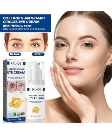 Jasmine Ointment for Dark Circles & Wrinkles - 2PCs Kaluofan Eye Cream with Collagen & Aloe Vera - Buy Online on GoSupps.com