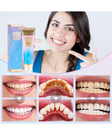 Niacinamide Whitening Toothpaste - Intensive Stain Removal & Fresh Breath | 1 PC International Shipping - Buy Online on GoSupps.com