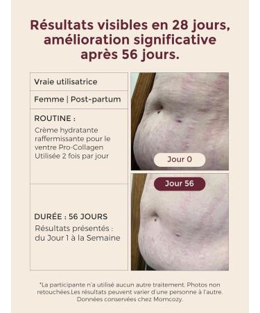 Momcozy Creme Vergeture Grossesse Format Voyage 30 g Cr me Peau S che Beurre Corporel Pr vention Vergetures Femme Enceinte Peptides & Beurre de Karit Soin de Grossesse 30 g (Lot de 1) - Buy Online on GoSupps.com