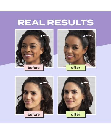 Toppik Hair Filler Keratin Hair Fiber 12g - Dark Brown Hair Thickener for Women - Fuller Looking Hairstyles - Hair Fiber Powder - Buy Online on GoSupps.com