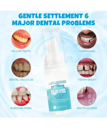 2 Pack 50ML Teeth Whitening Foam Mouthwash for Deep Cleaning and Fresh Breath - Buy Online on GoSupps.com