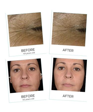 Yoga Skin Oxygenating Neuroactive Wellness Cream - Antioxidants & Vitamins B C D E for Radiant Skin - Buy Online on GoSupps.com