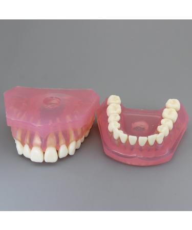 Dental Implant Teeth Model - Standard Study and Teaching Tool with Removable Teeth - Buy Online on GoSupps.com
