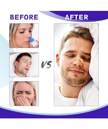 Nose Plaster Snoring Solution - Anti-Snore Nasal Strips for Blocked Nose Relief (30 Pieces) - Drug-Free Extra Strong for Sports & Sleep - Buy Online on GoSupps.com