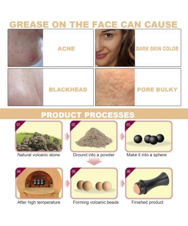 Volcanic Stone Roller Volcanic Face Roller Oil Control Volcanic Roller Reusable Facial Skin Care for Eyes for Ily and Acne Prone Skin. for Face - Buy Online on GoSupps.com