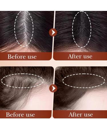  Utapossin Hairline Powder - Buy Online on GoSupps.com