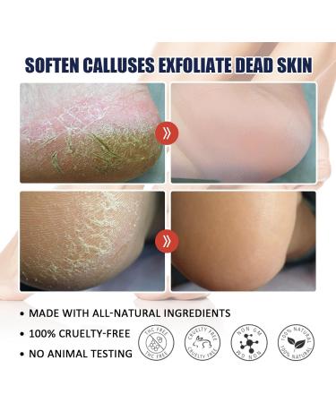 Urea 40% Foot Cream Cracked Heel Repair Cream Foot Cream for Cracked Heels and Dry Skin Cracked Heel Repair Cream Urea Foot Cream Foot Moisturiser Skin Care Hands & Feet Cracked Heel Cream Heel Repair - Buy Online on GoSupps.com