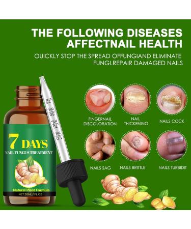 CGACCSD Nail hardener oil light nonsticky nail growth oil nutrientrich hardening repair gel for home care - Buy Online on GoSupps.com