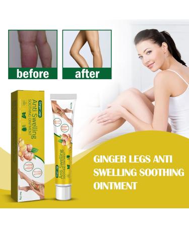 Antihump Lymphcare Ginger Ointment Antihump Ginger Ointment Ginger Legs Anti Swelling Cream Ginger Anti Cellulite Ointment Anti Cellulite Ointment Ginger Soothing Cream Anti Cellulite Leg Ointment 2PC - Buy Online on GoSupps.com