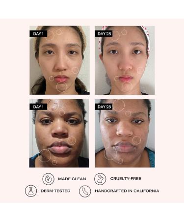 Odacite Clarifying Salicylic & Hyaluronic Acid Serum for Acne - Reduce Blemishes & Clogged Pores - 1 Fl Oz | International Shipping Available - Buy Online on GoSupps.com