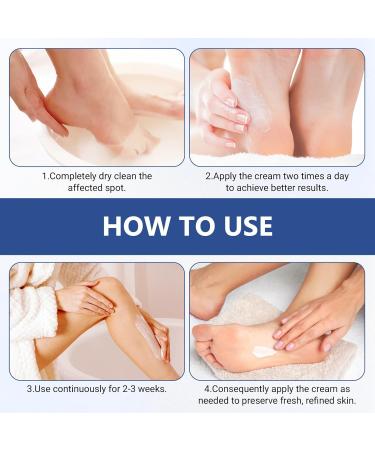 Juadnic Urea Cream contains 60 urea cream and 2 salicylic acid which deeply nourishes repairs dry cracks and removes calluses It is suitable for heels and elbows - Buy Online on GoSupps.com