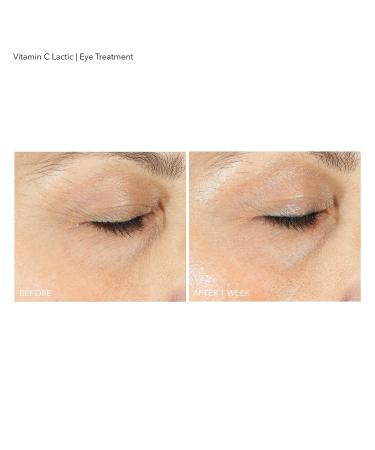 Dr. Dennis Gross Vitamin C Lactic Eye Treatment - Reduce Lines, Wrinkles, Dark Circles & Puffiness - 0.5 oz - Buy Online on GoSupps.com