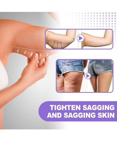 YOENBG Arm Firming Cream - 2025 - New lifting and firming cream for sagging skin - Anti-aging formula to reduce wrinkles and firm skin for a more toned appearance - Buy Online on GoSupps.com