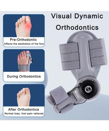 Bunion Corrector for Women & Men | Adjustable Bunion Splint with Soft Silicone Pad for Big Toe Relief - White Black Buckle - Buy Online on GoSupps.com