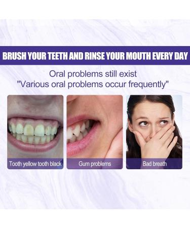 Advanced Teeth Whitening Toothpaste - Deep Cleaning Anti-Stain Formula for Yellow Teeth Freshens Breath & Relieves Gum Discomfort(1PCS) 1 Count (Pack of 1) - Buy Online on GoSupps.com