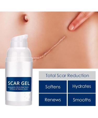 Silicone Scar Gel - Scar Cream - 30g Scar Removal - Scar Treatment - Scar Gel for Surgical Scars C-Section Stretch Marks Acne Injury Burns Old and New Scars - Buy Online on GoSupps.com