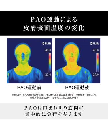 MTG Facial Fitness PAO Black - Tone and Strengthen Facial Muscles - Buy Online on GoSupps.com