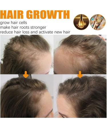 Nmbol Hair Mask Biotin Conditioner for Hair Thickness Biotin Premium Hair Growth Conditioner Biotin & Collagen Conditioner Hair Cream for Hair Growth Collagen Wheat Proteins 120ml - Buy Online on GoSupps.com