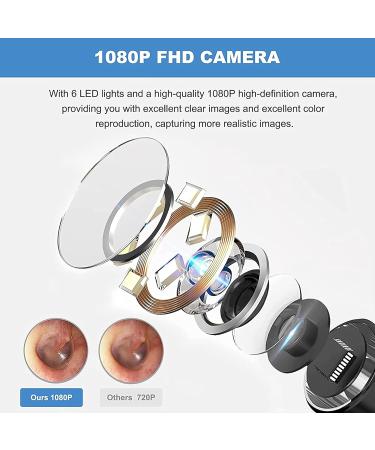 1080P FHD Ear Wax Removal Kit Camera with LED Lights & Silicone Spoons - Smart Wireless Ear Scope for Men Women Kids - iOS Android Compatible (Black) - Buy Online on GoSupps.com