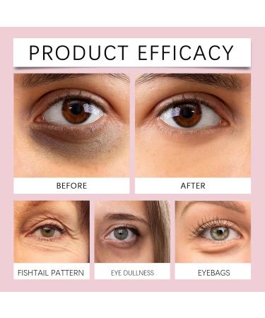 Eye Serum Roller Glow All In Eye Cream with Niacinamide & Peptides for Dark Circles Puffy Eyes Eye Bags Wrinkles - Under Eye Brightener - Eye Roller with Retinol & Niacinamide (2pc ) - Buy Online on GoSupps.com