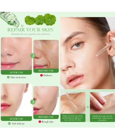 BIOAQUA Centella Asiatica Serum - Soothing Repair Oil Control & Anti-Acne Skin Care - 30ml - Buy Online on GoSupps.com
