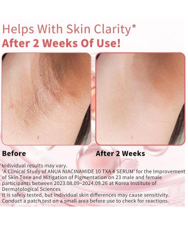 HYNAUT Premium Selection 30% Niacinamide Vitamin B3 High-Concentration Serum Anti-Aging Facial Serum Brightens Dull Complexion & Minimizes Pores Fragrance-Free 30g (1 oz) - Buy Online on GoSupps.com