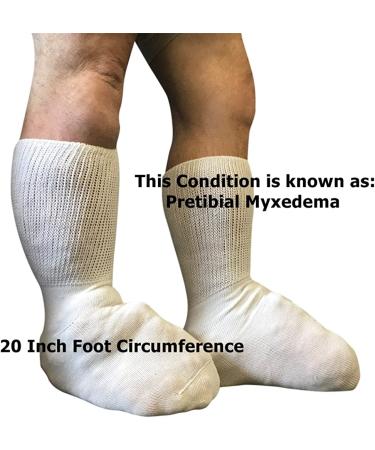 Bariatric Lymphedema Calf Sock - 30 Inch Stretch - Black - Buy Online on GoSupps.com