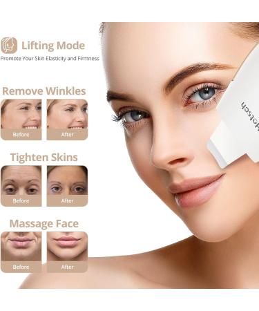 Hotsch Skin Scrubber Face Spatula - Ultrasonic Blackhead Remover and Pore Cleaner with 3 Modes - Rechargeable Facial Cleansing Tool - Buy Online on GoSupps.com