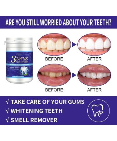 3 Days Purple Teeth Whitening Powder Teeth Whitening Powder for White Teeth Teeth Whitening and Bleaching Powder with Visible Cleaning Effect | Whiten Teeth - Cosmetic Teeth Cleaning (1) - Buy Online on GoSupps.com