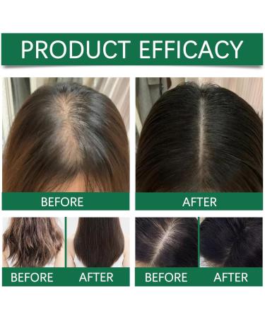  ZLHHRZJX Rosemary Oil Wrap Hair Serum (20ml) for Healthy Hair Growth Natural Scalp Serum for Men and Women Nourishing Hair Serum Wrap - Buy Online on GoSupps.com