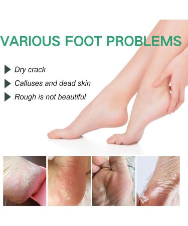 Foot Cream for Very Dry Feet Cracked Heel Repair Cream Callus Remover Foot Moisturiser Hard Skin Remover Foot Soften & Smooths Feet Deep Moisturizing Nourishing Formula for Feet Care - Buy Online on GoSupps.com