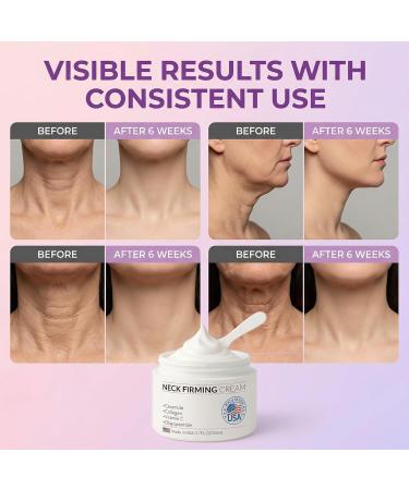 SkiEssance Neck Firming Cream for Face Neck & D collet Anti-Aging Moisturizer with Ceramides Collagen Vitamin C & Peptides Lightweight Non-Greasy Made in USA 1.7 fl oz - Buy Online on GoSupps.com