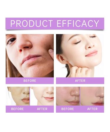 Blueberry Facial Cleansing Gel - Gentle Cleanser For Deep Cleanse Hydration & Moisture Leaves Skin Fresh & Smooth(1PCS) - Buy Online on GoSupps.com