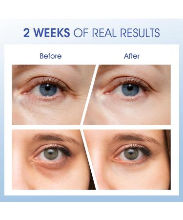 Eye Cream for Wrinkles, Fine Lines & Crows Feet - With Ceramides, Peptides + Caffeine + Niacinamide - Anti Aging Skin Renewing Under Eye Cream for Men and Women, 0.5 Oz Unscented - Buy Online on GoSupps.com