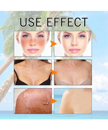 Hyaluronic Acid Watery Sun Gel Korean Sunscreen Spf+50+++ Sunscreen Korean Watery Sun Gel Sunscreen for Oily Skin Sunscreen Face Moisturiser Moisturizing Korean Suncream with No White Cast 50ml - Buy Online on GoSupps.com